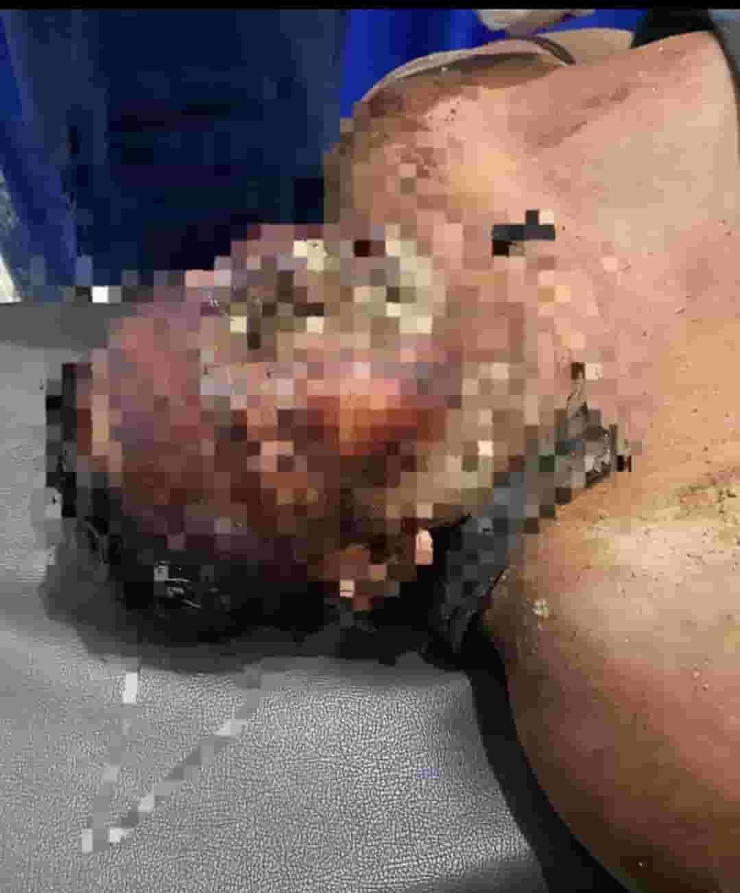 Tragedi Penyerangan di Lahan Eks HGU PT BSP Asahan, Warga Kelompok Tani Babak Belur dan Nyaris Tewas
