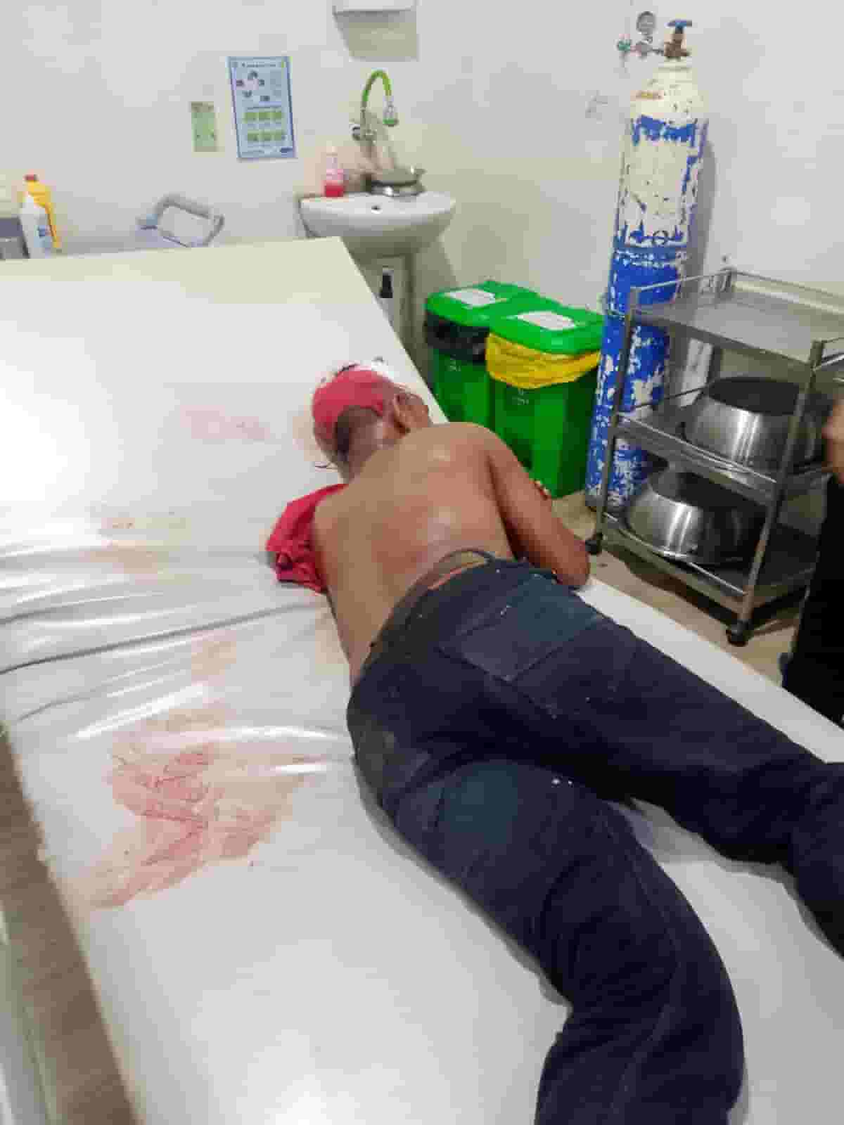 Sadis, Sekelompok Pemuda Bacok Sekuriti Gudang di Labuhan Deli